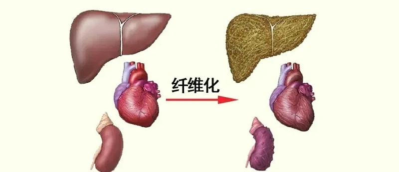 水蛭素、活血化瘀、纖維化