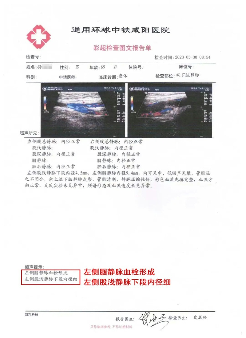 水蛭素、水蛭素膠囊、壯醫(yī)水蛭療法