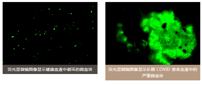 水蛭素、老年癡呆、前列腺、陽(yáng)康