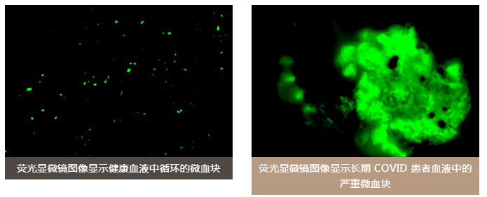 水蛭素、陽康、烏梅、壯醫(yī)水蛭療法